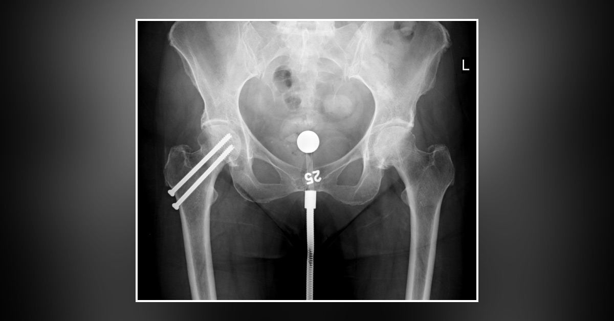 Spot the Diagnosis