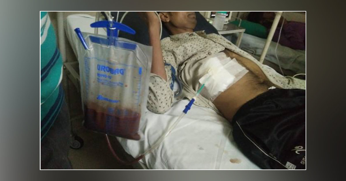 Treated A Huge Liver Abscess