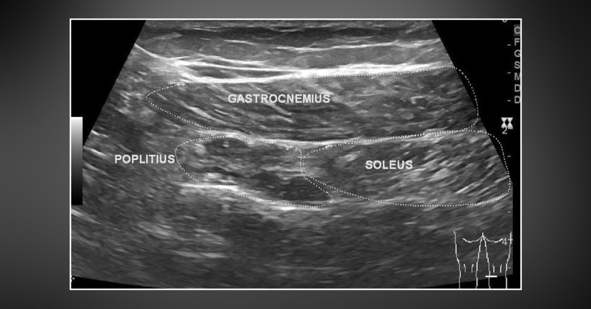 Can You Diagnose This Case?
