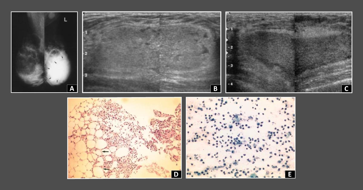 Can You Diagnose This Patient?