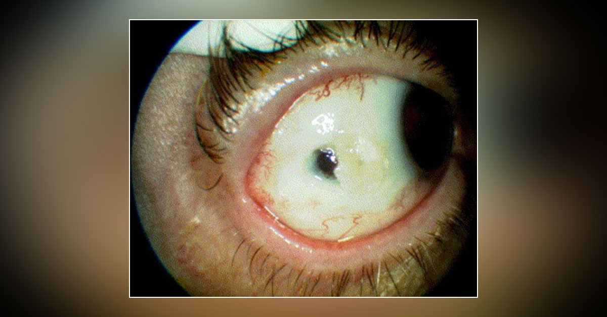 Spot the Ophthalmic Condition