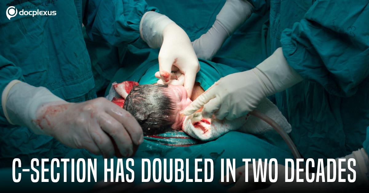 Global C-Section 'Epidemic': What's Your Take?