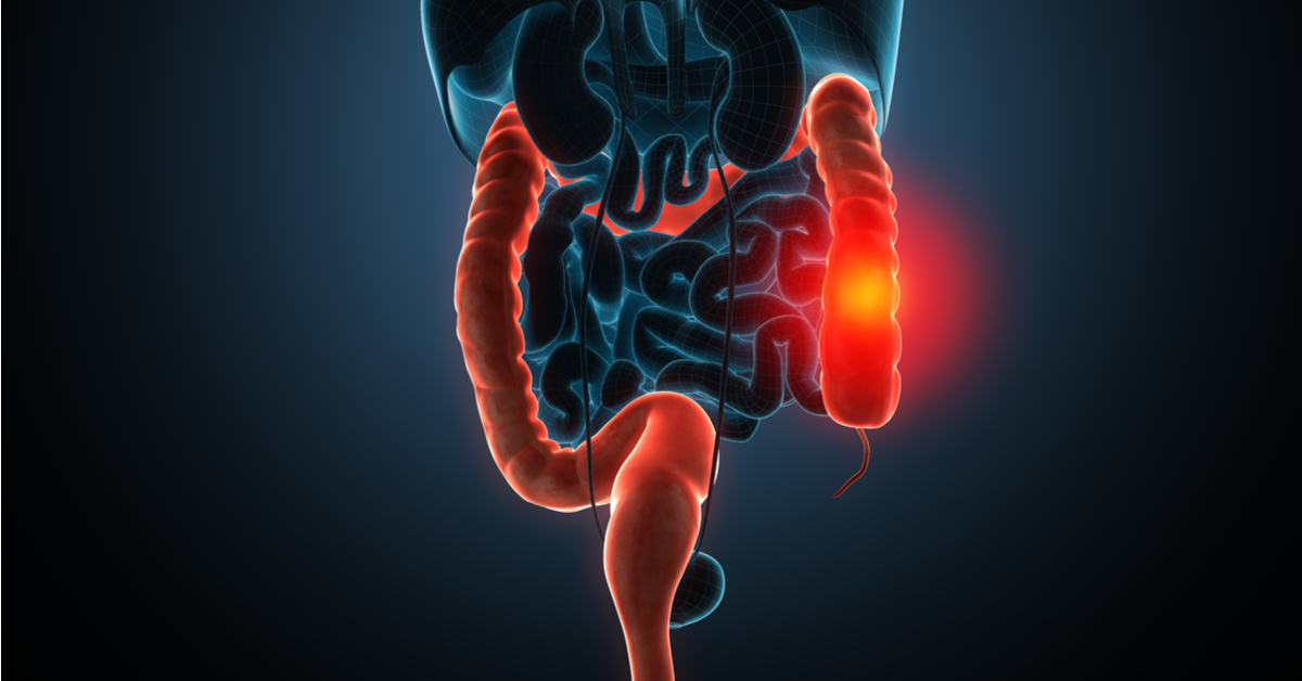 Indian American Scientist Finds Simple Way To Predict Inflammatory Bowel Disease