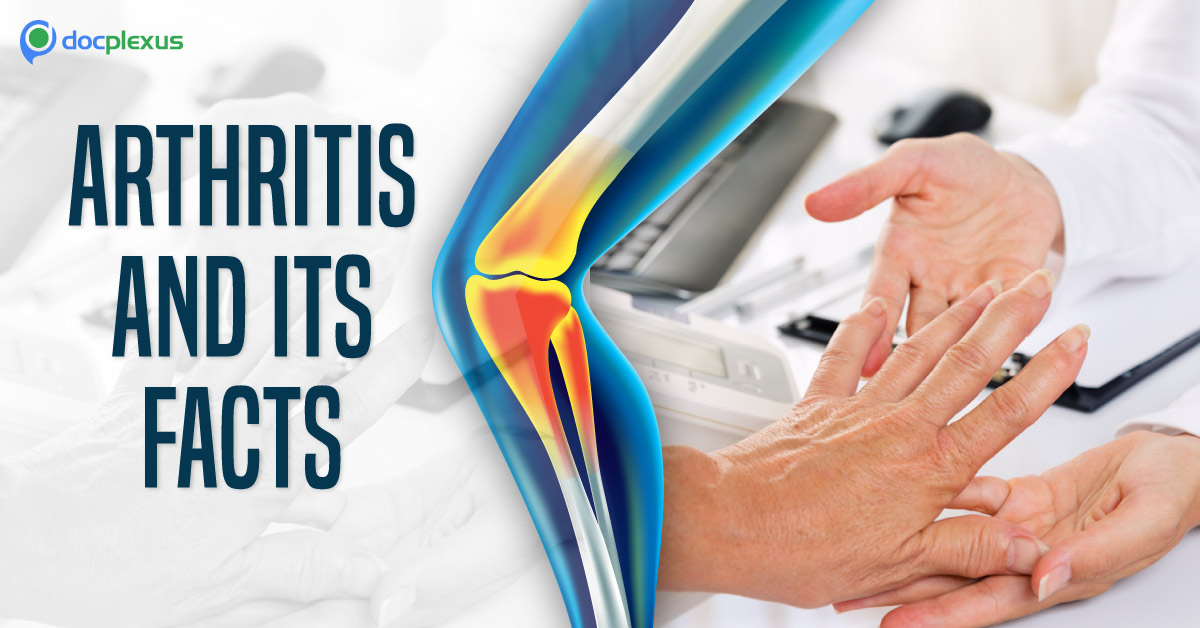 Arthritis: Current Statistics And Management Guide