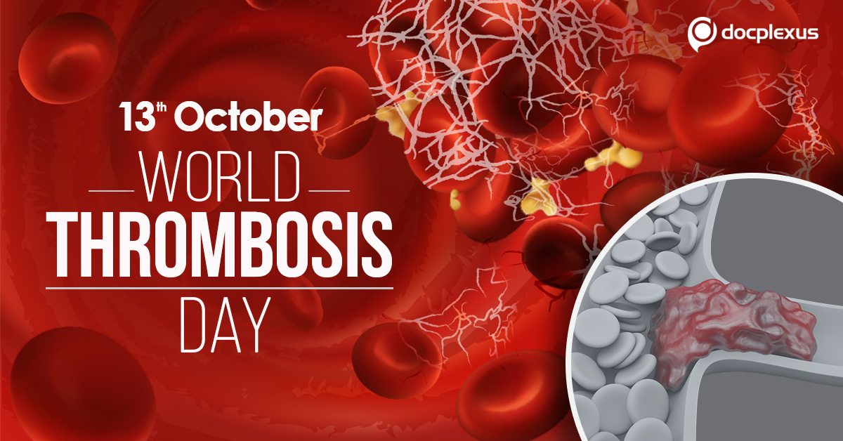 Fight To Keep Down Thrombosis In India