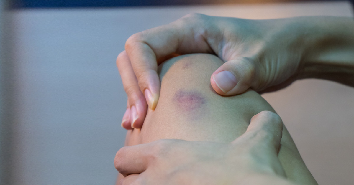 A Case of Tender Patches on the Skin