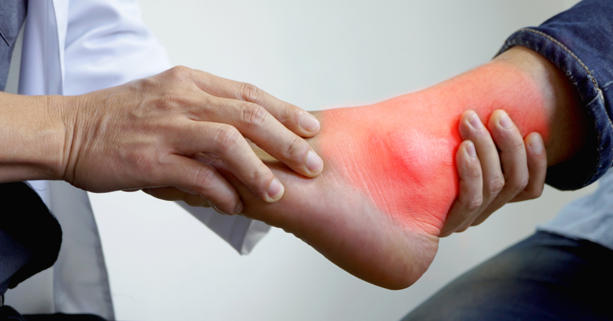 Study Challenges Gout Is Primarily Caused By Diet