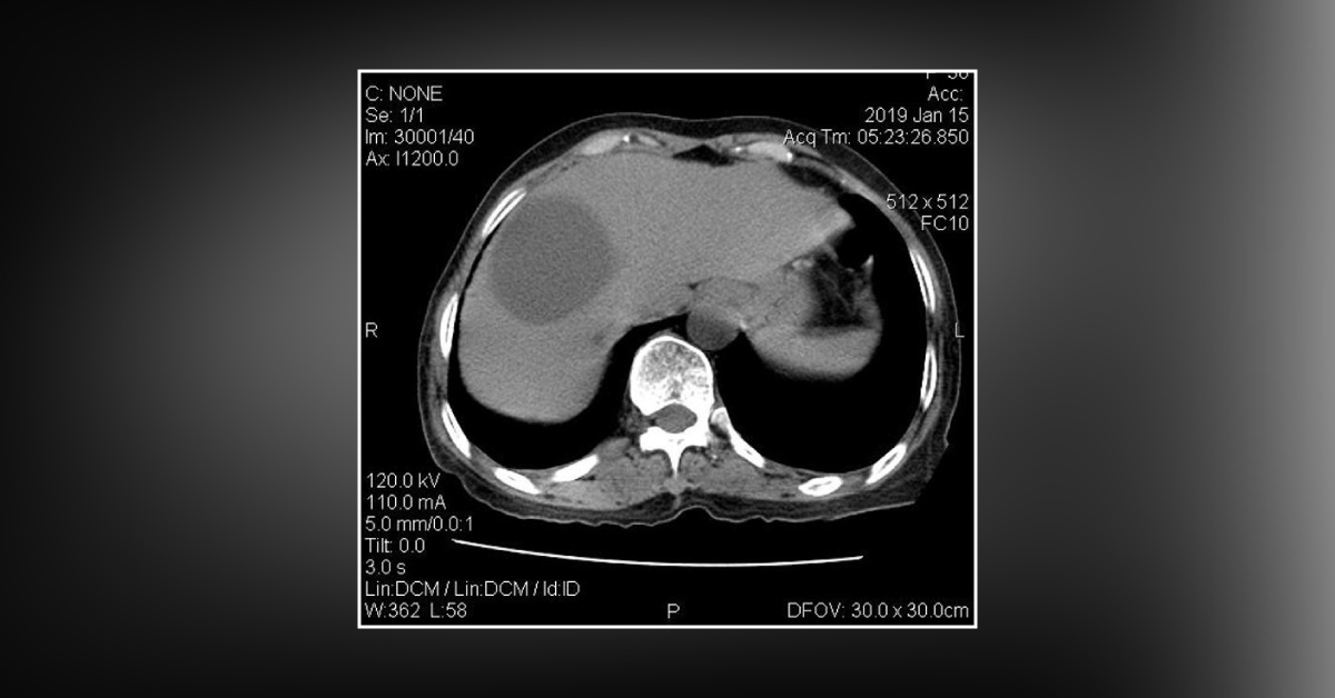 Woman Complained Of Pain Of Moderate Degree