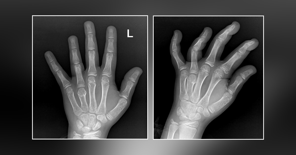 Case of a Boy with Wrist Injury