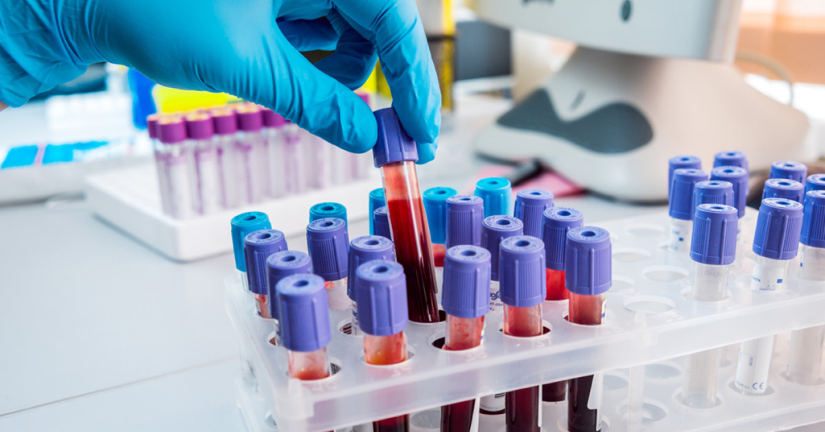 Diagnosis Of Cancer With A Simple Blood Test