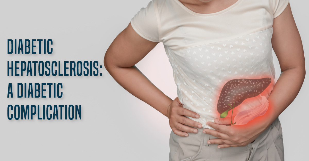 Diabetic Hepatosclerosis: A Hepatic Complication of Diabetes