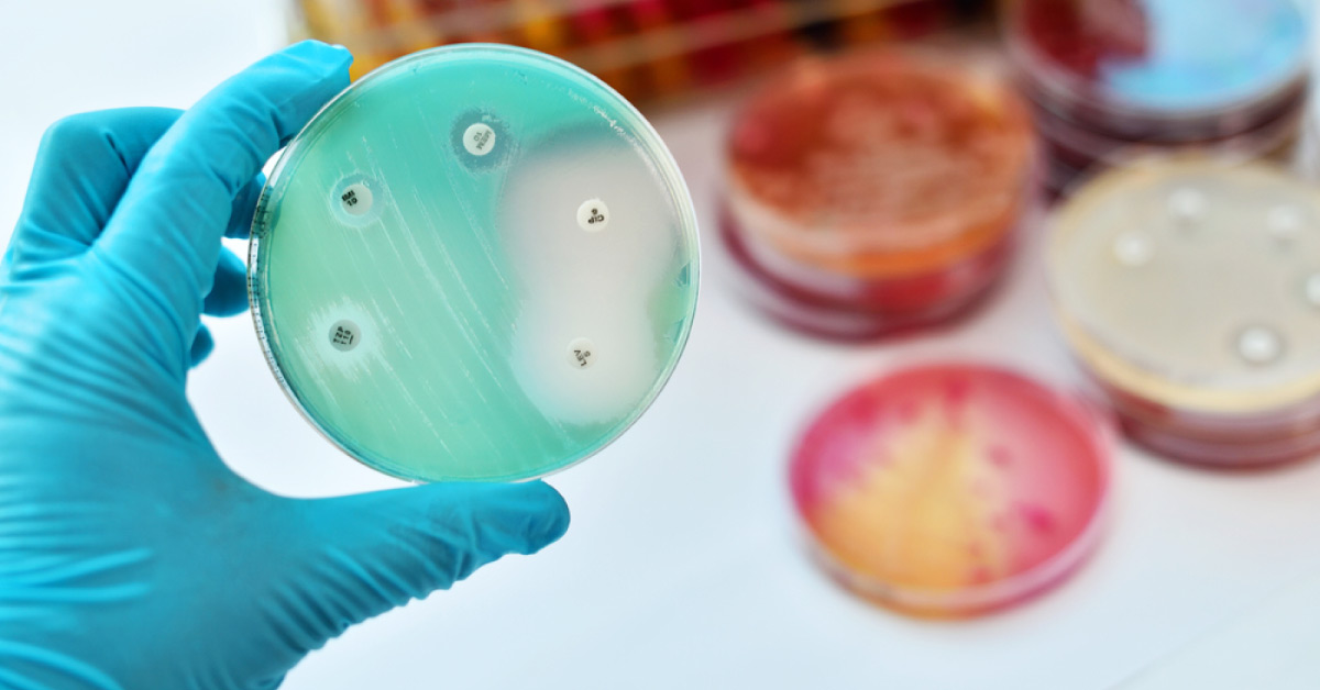 Rapid Antimicrobial Susceptibility Test on Urine Samples