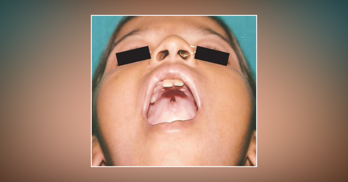 Identify the Condition