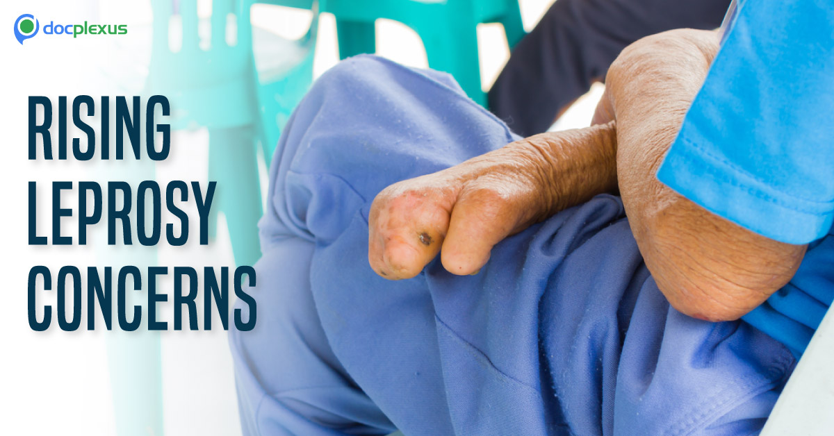 Clinical Viewpoint On Management Of Leprosy