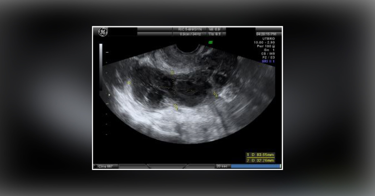 Diagnose a Case of Pelvic Pain