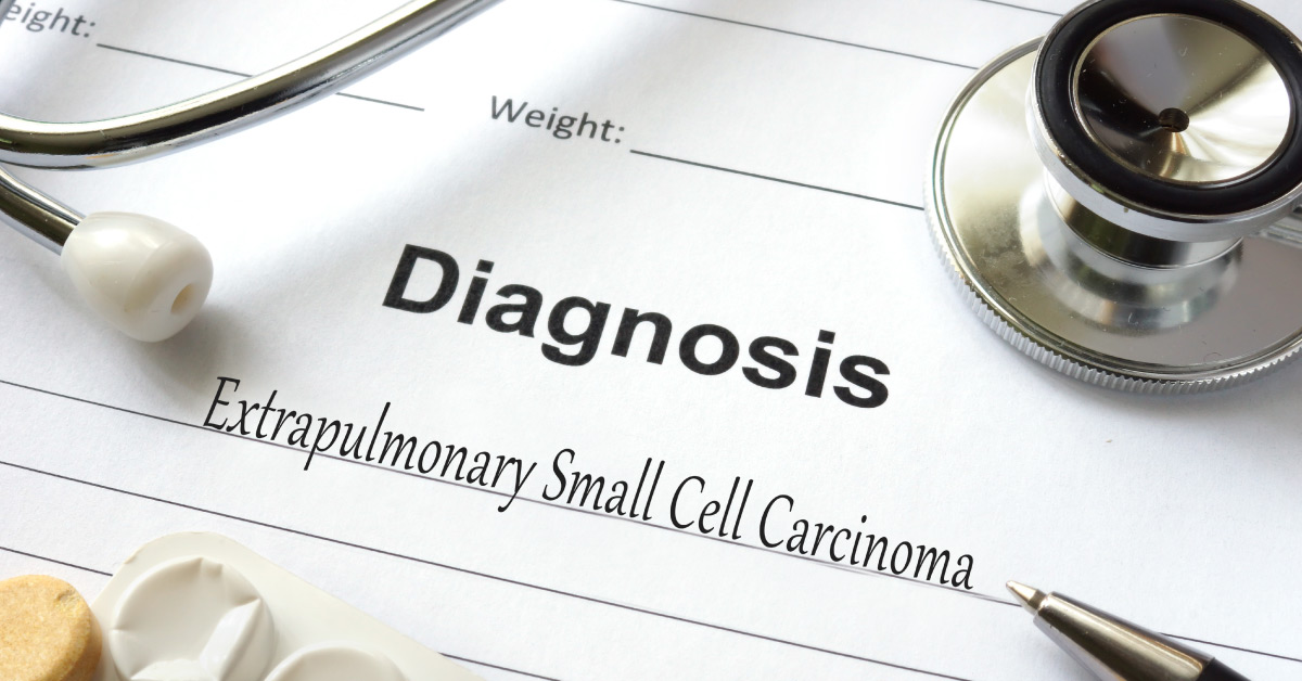 Extrapulmonary Small Cell Carcinoma - A Case Series