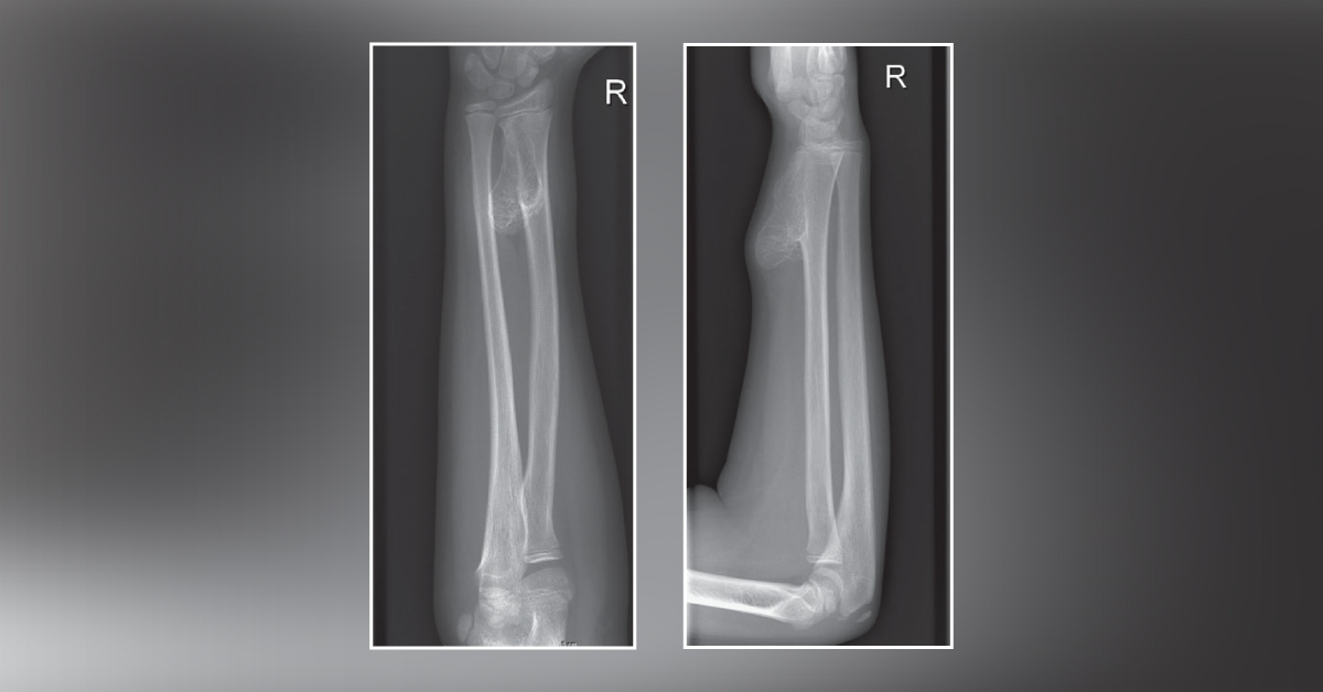 A Case of a Painful Wrist