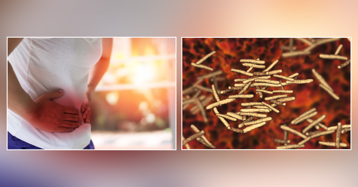 Mycobacterium Avium Paratuberculosis:a Potential Causative Agent Of Crohn's Disease