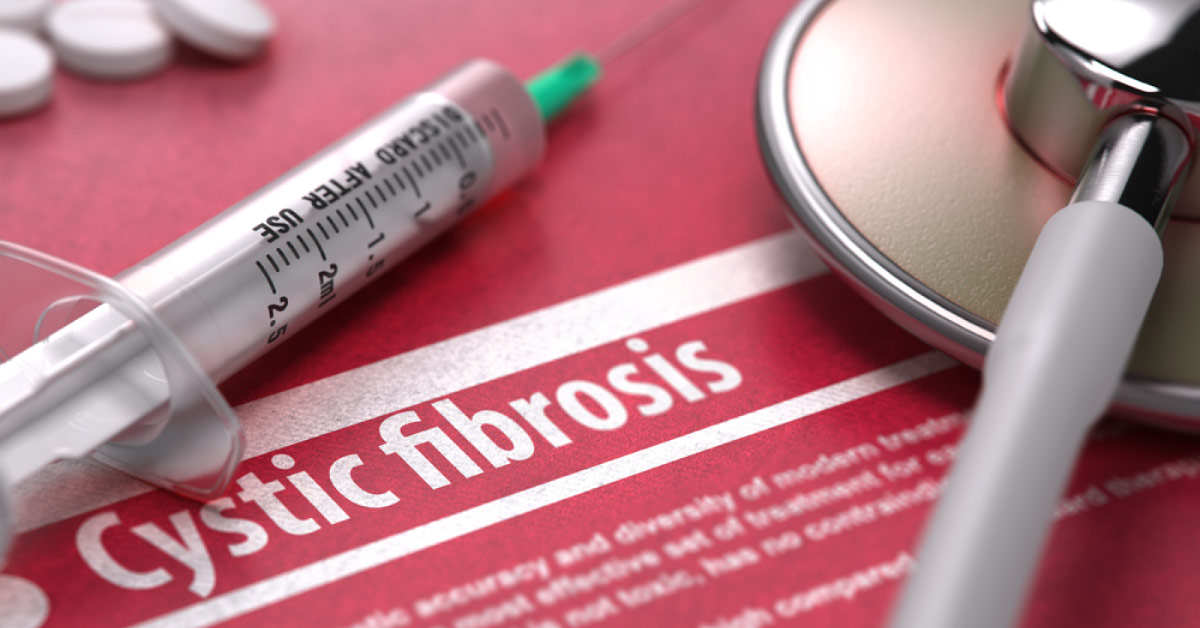 How Do You Confirm Cystic Fibrosis When Sweat Chloride Test Fails?