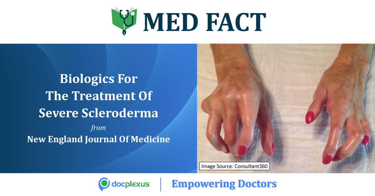 Is Stem Cell Treatment Beneficial For Treating Severe Scleroderma?