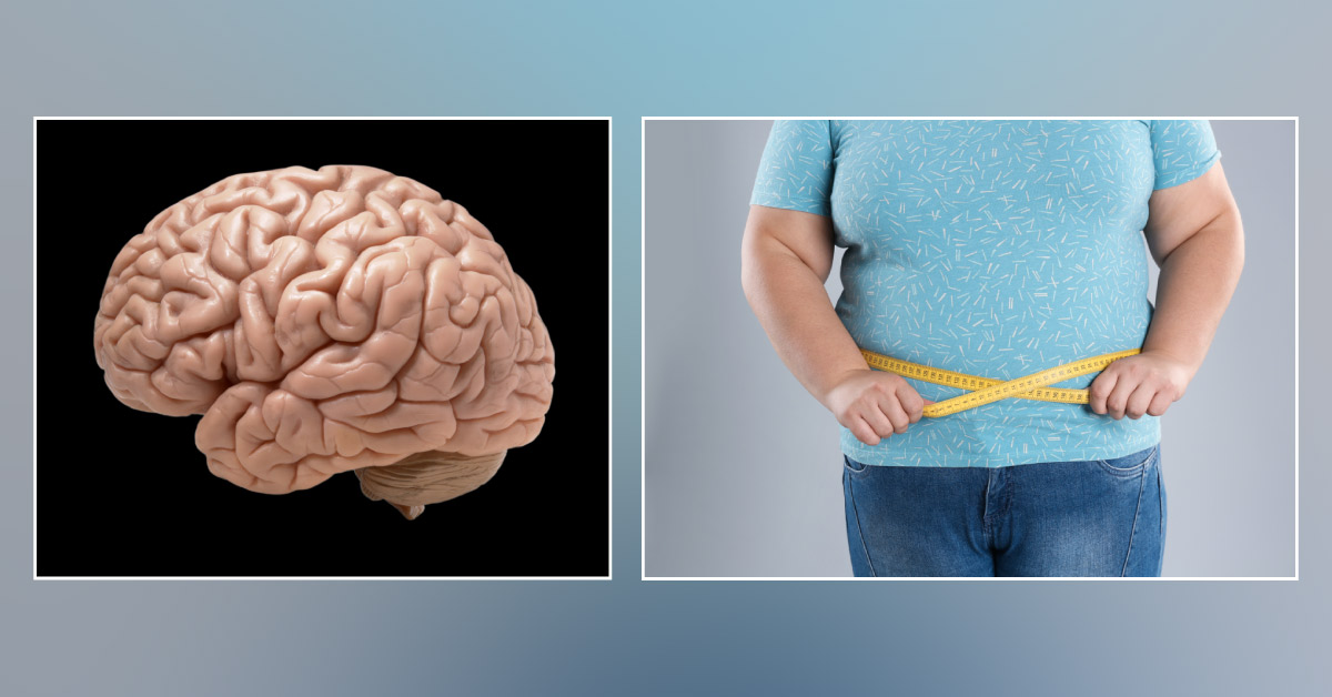 Excessive Body Fat May Shrink Your Brain: Study
