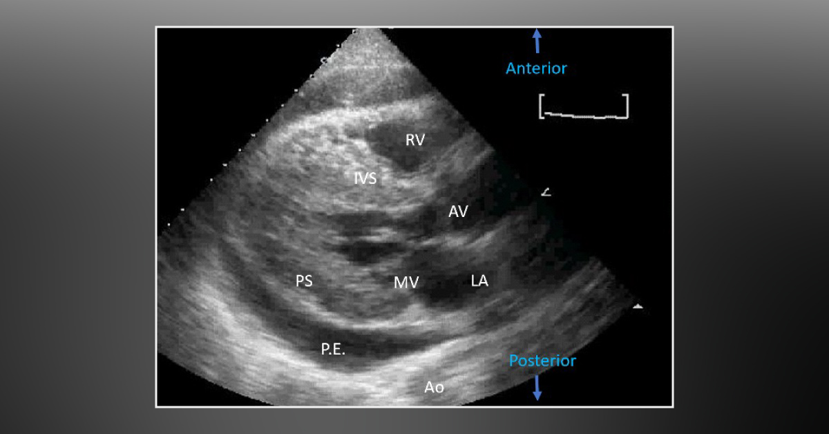 A Man with Sharp and Stabbing Chest Pain