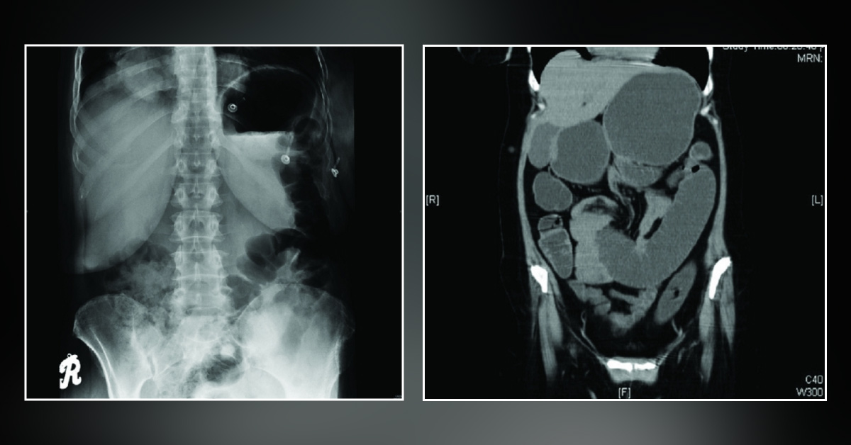 Can You Diagnose This Case?