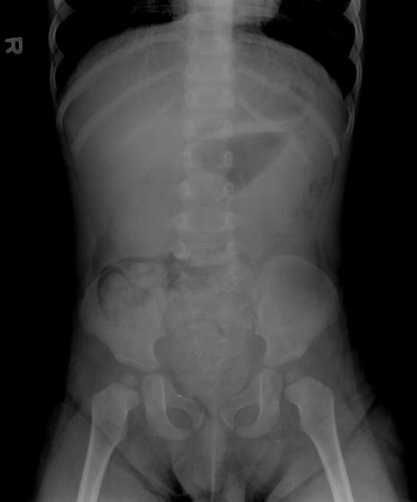 A Case of Abdominal Pain
