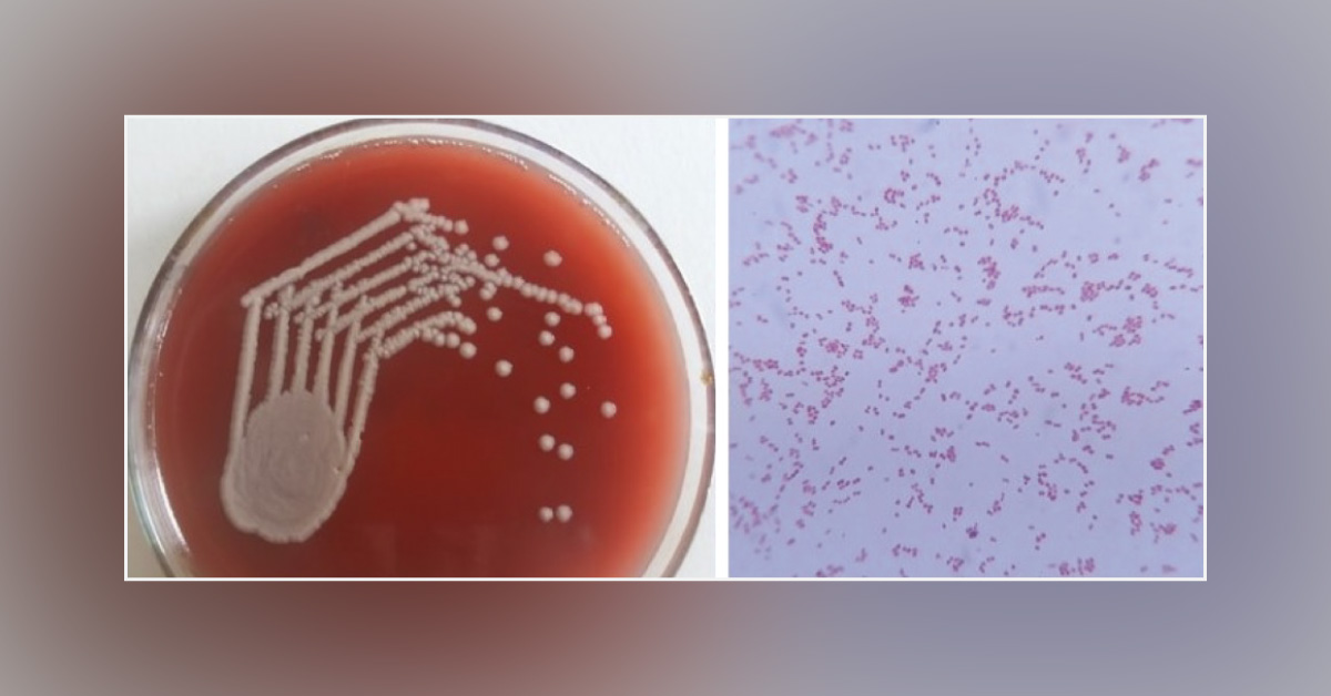 Case of a Newborn with Yellowish Skin Discoloration: What Can Be the Cause?