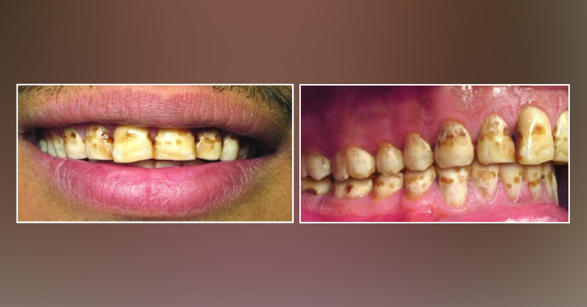 Identify This Dental Condition