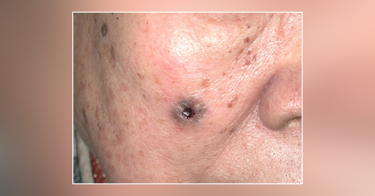 What's the Diagnosis?