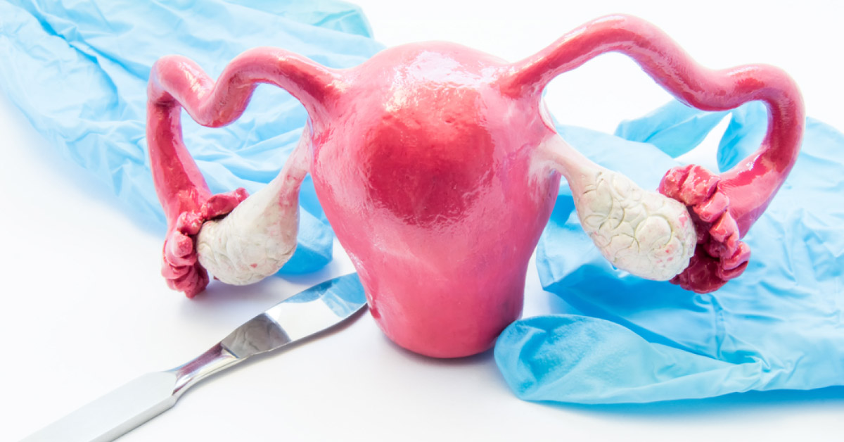 Complications of Total Laparoscopic Hysterectomy