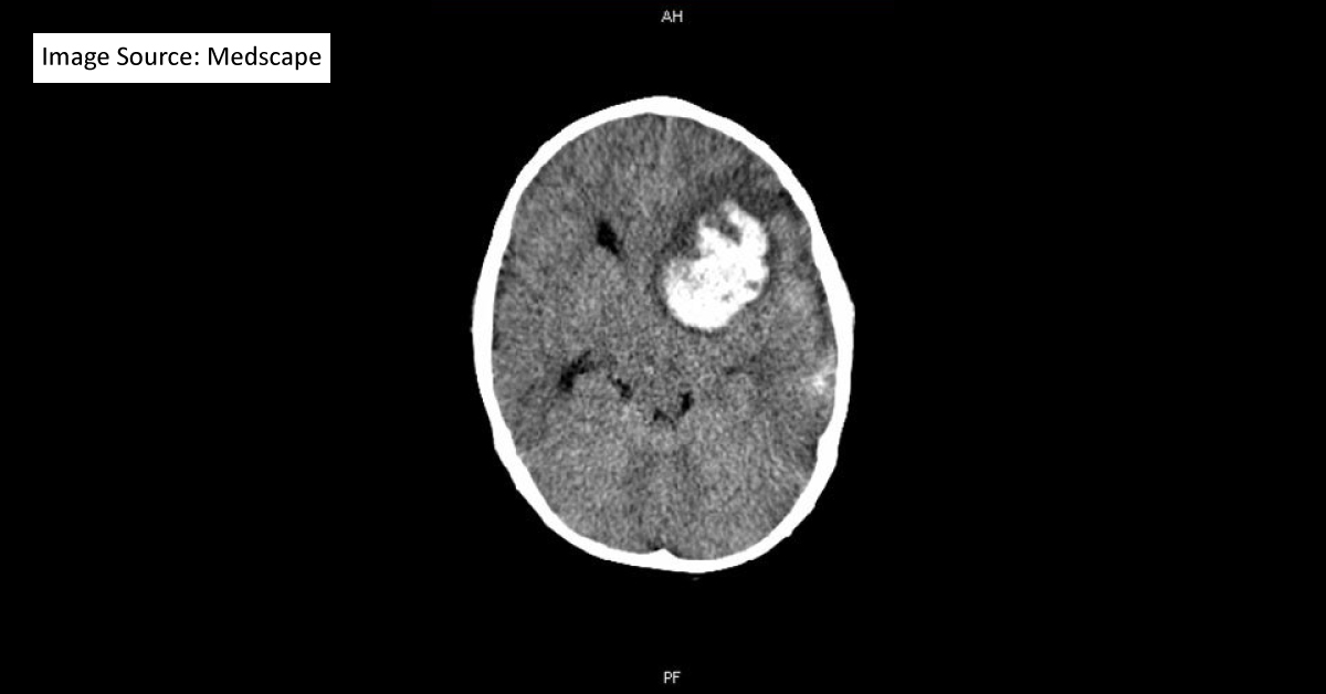 A 2-year-old Boy with Sickle Cell Anemia