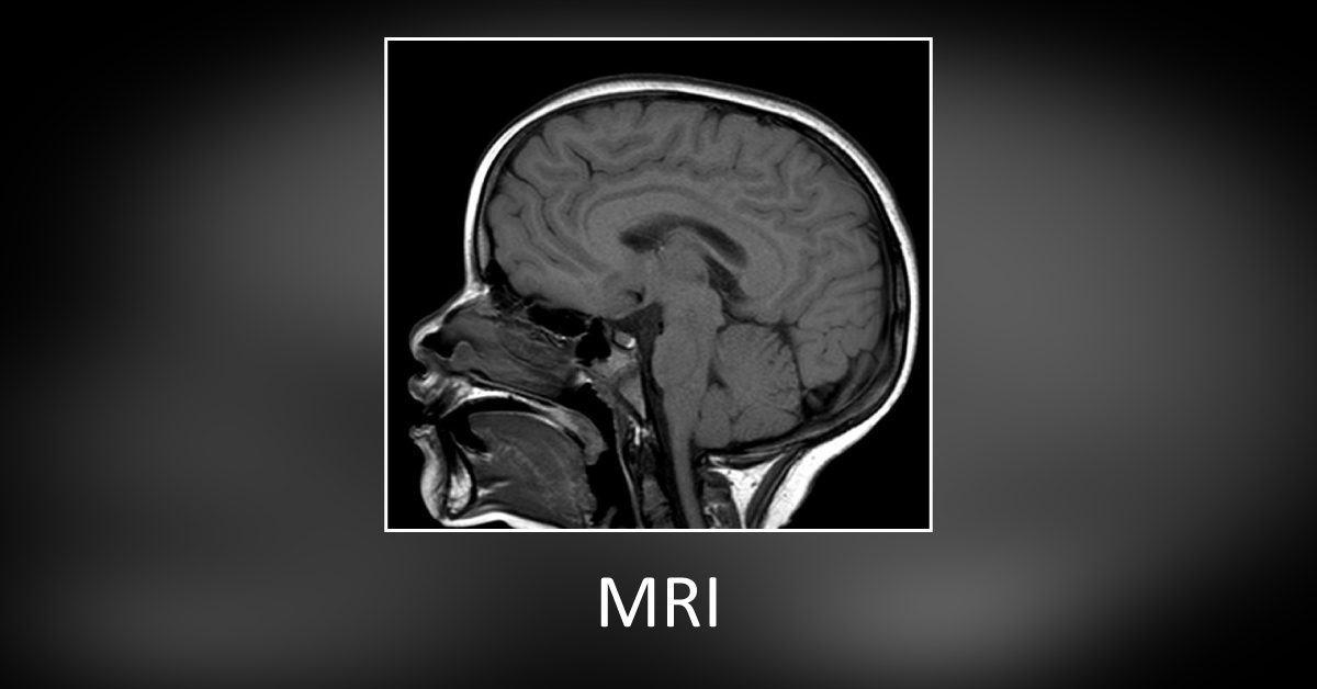Solve This Clinical Case