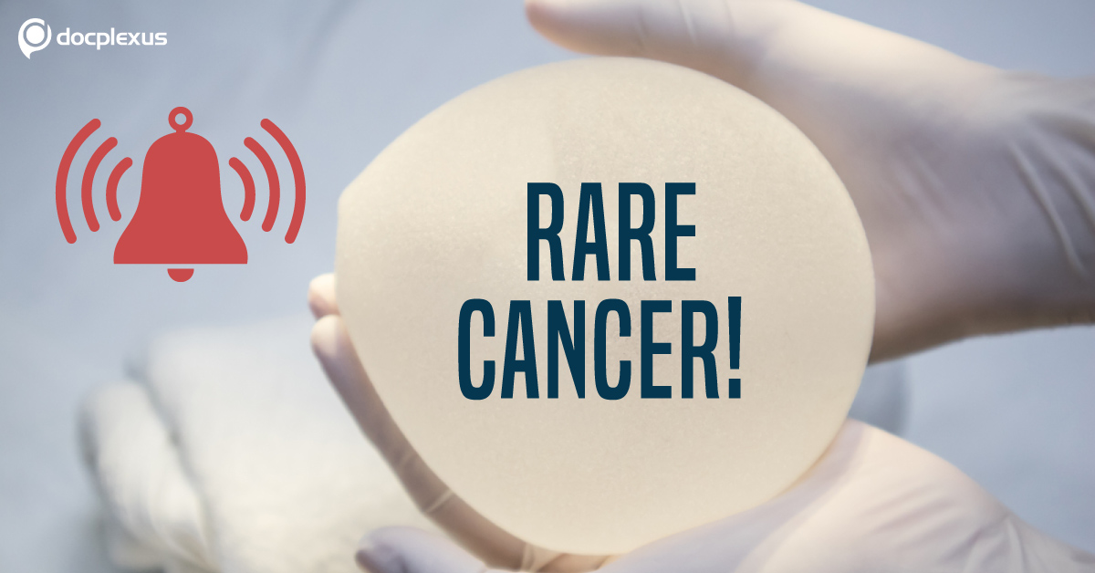 Alarm For Doctors: Rare Cancer Associated With Breast Implants!