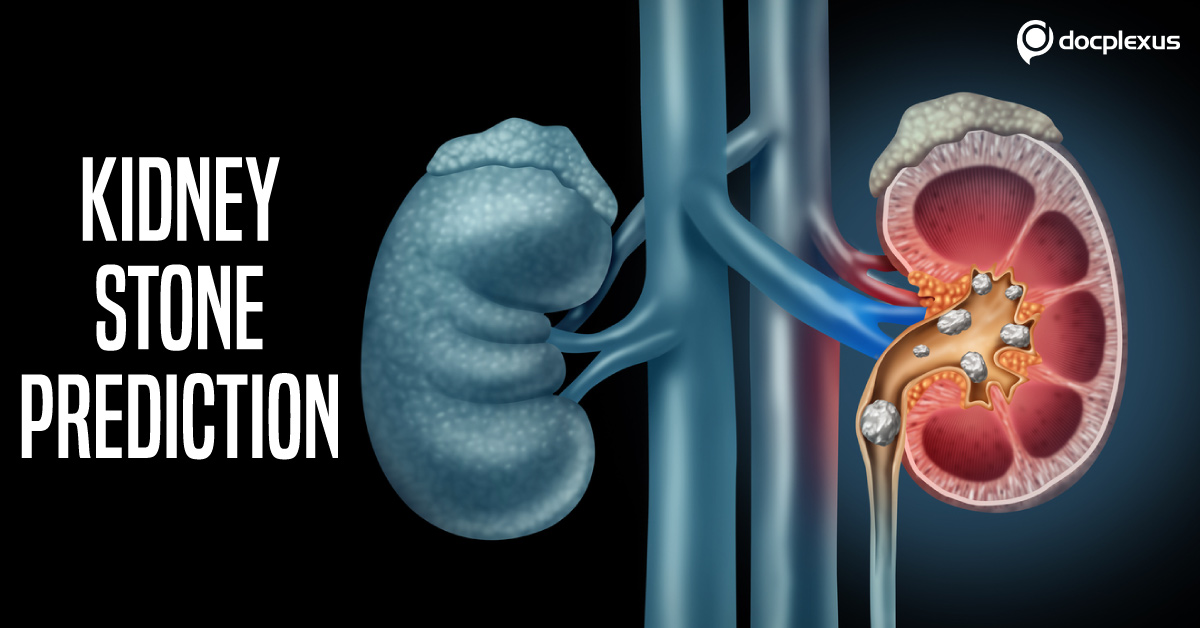 Kidney Stone Recurrence Predicting Tool