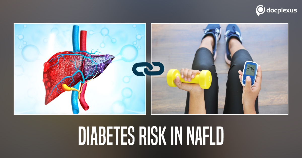 Increased Diabetes Risk In Non-Obese Subjects With Non-Alcoholic Fatty Liver