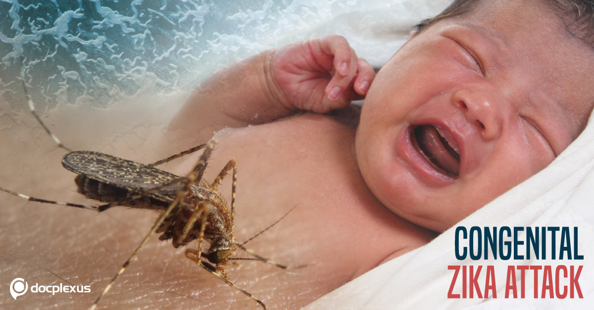 Congenital Zika Virus – Do We Know Enough?