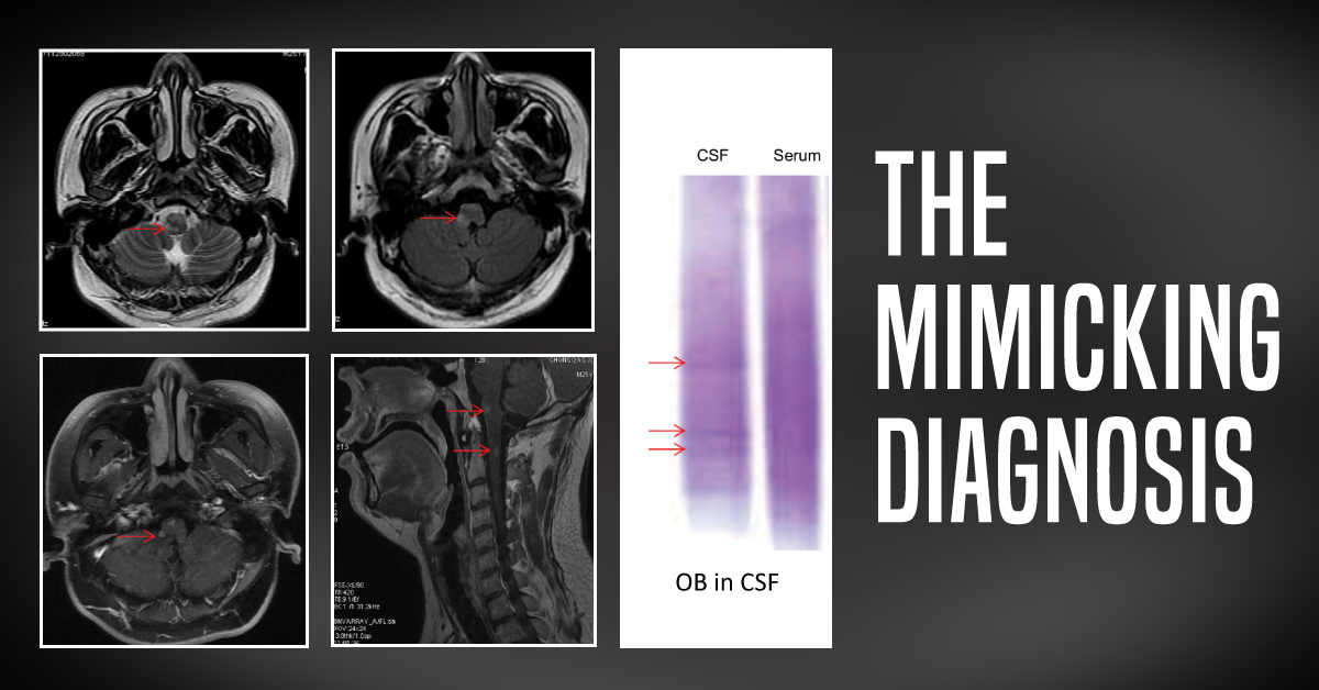 The mimicking diagnosis