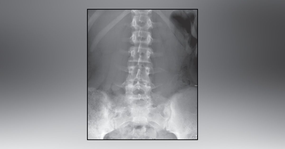 Interpret These Radiologic Findings