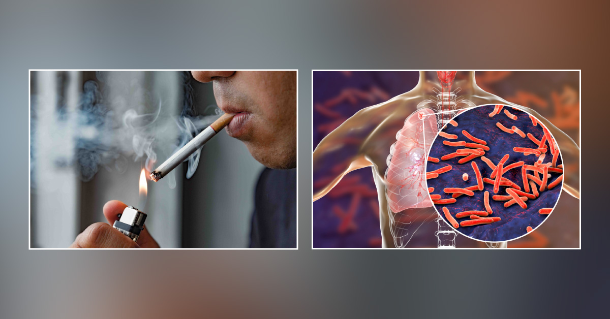 Smoking Tobacco Doubles Risk of Recurrent Tuberculosis