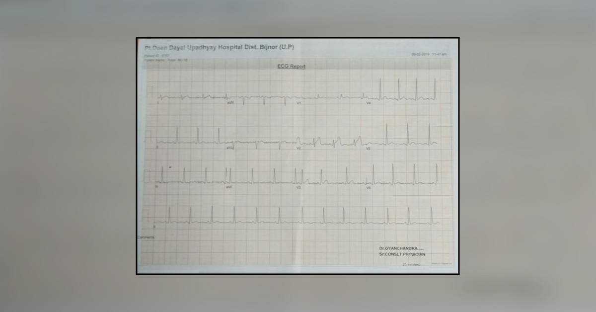 Episodic Chest Pain With Palpitations