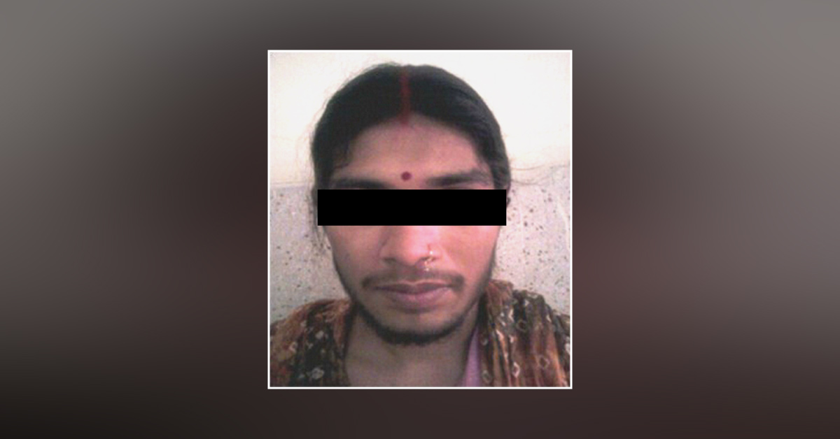 An Interesting Case of Secondary Hirsutism