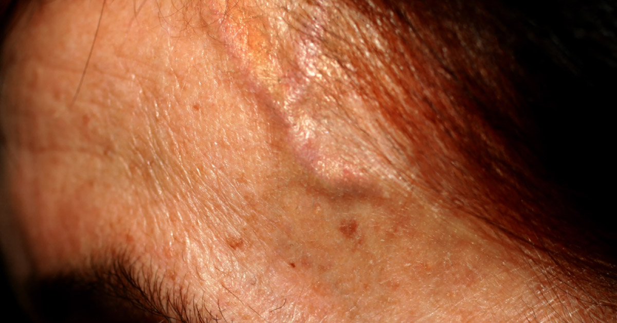 The Branches Of External Carotid Artery