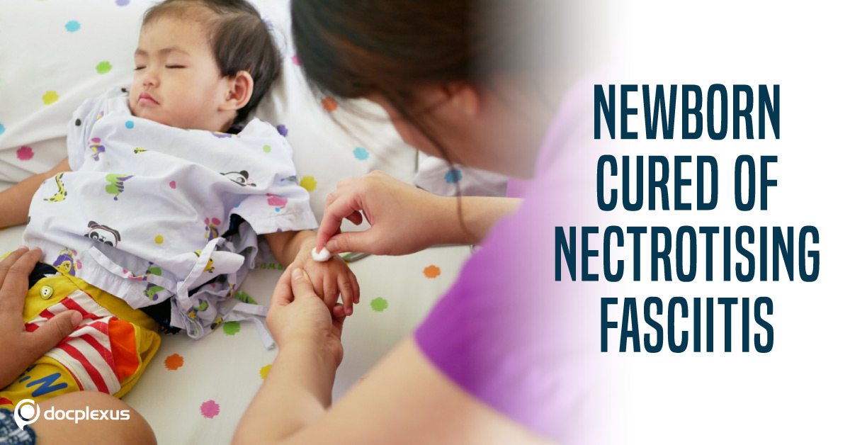 Newborn Saved From Necrotizing Fasciitis