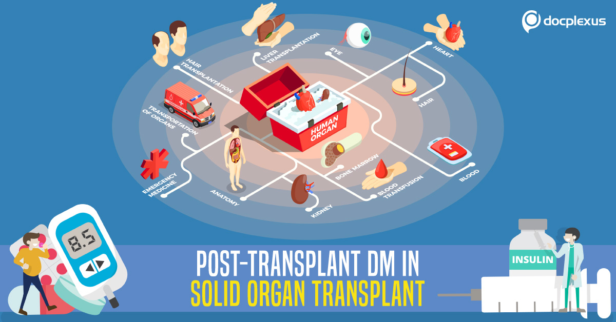 All You Need to Know About Post-transplant Diabetes Mellitus