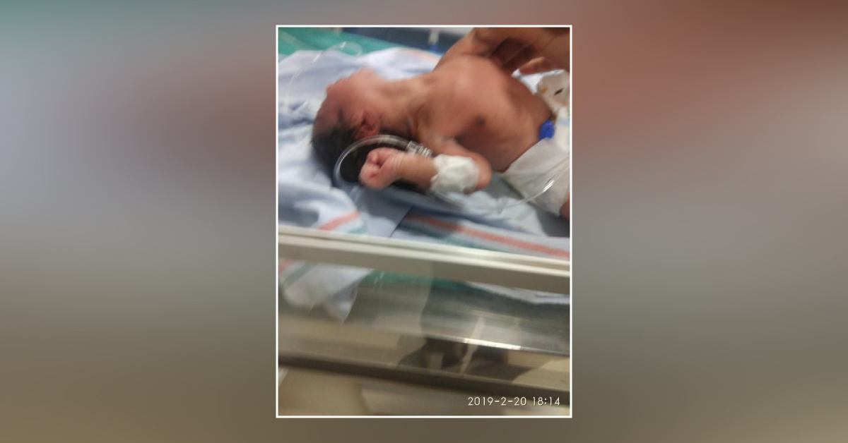 Hyperextension Of Neck In A Newly Born