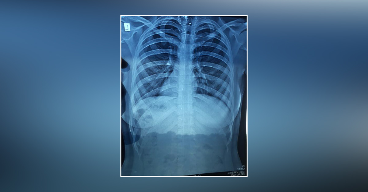 What Is The Diagnosis??