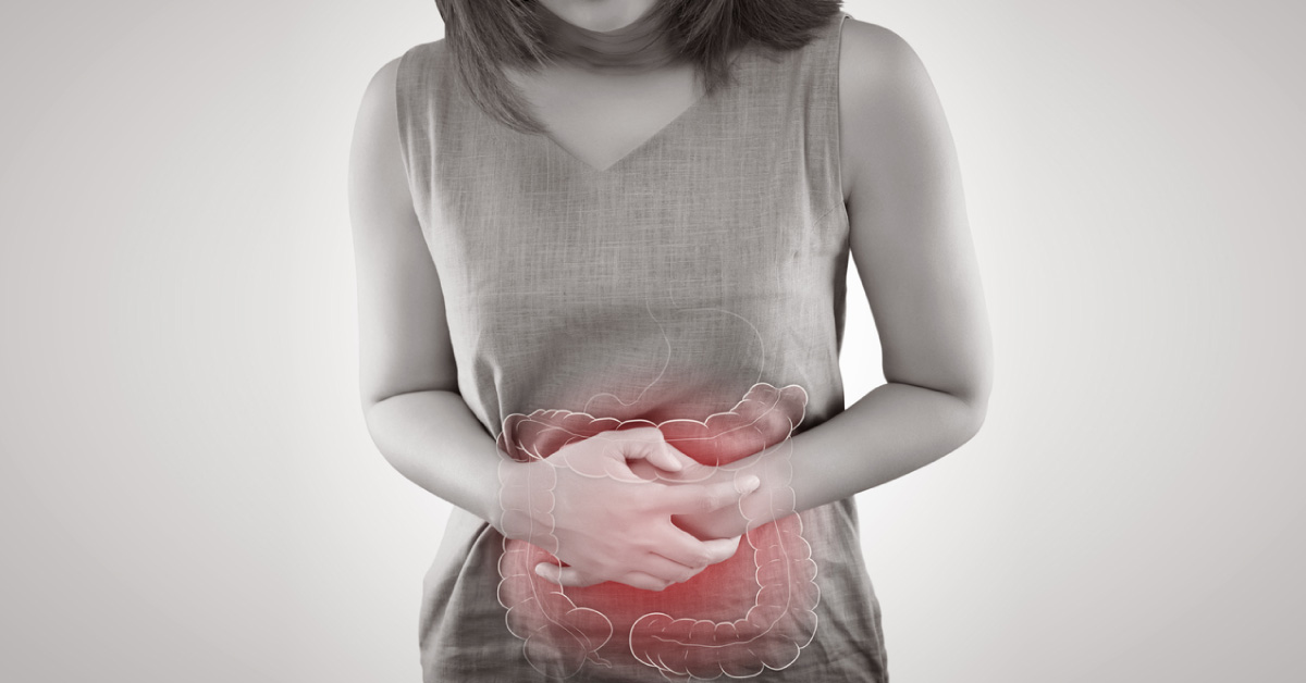 Bile and Fat Excretion Biomarkers for IBS