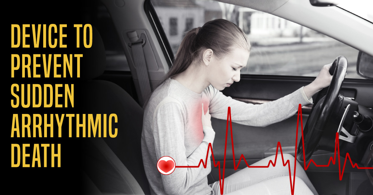 Wearable Cardioverter Defibrillator